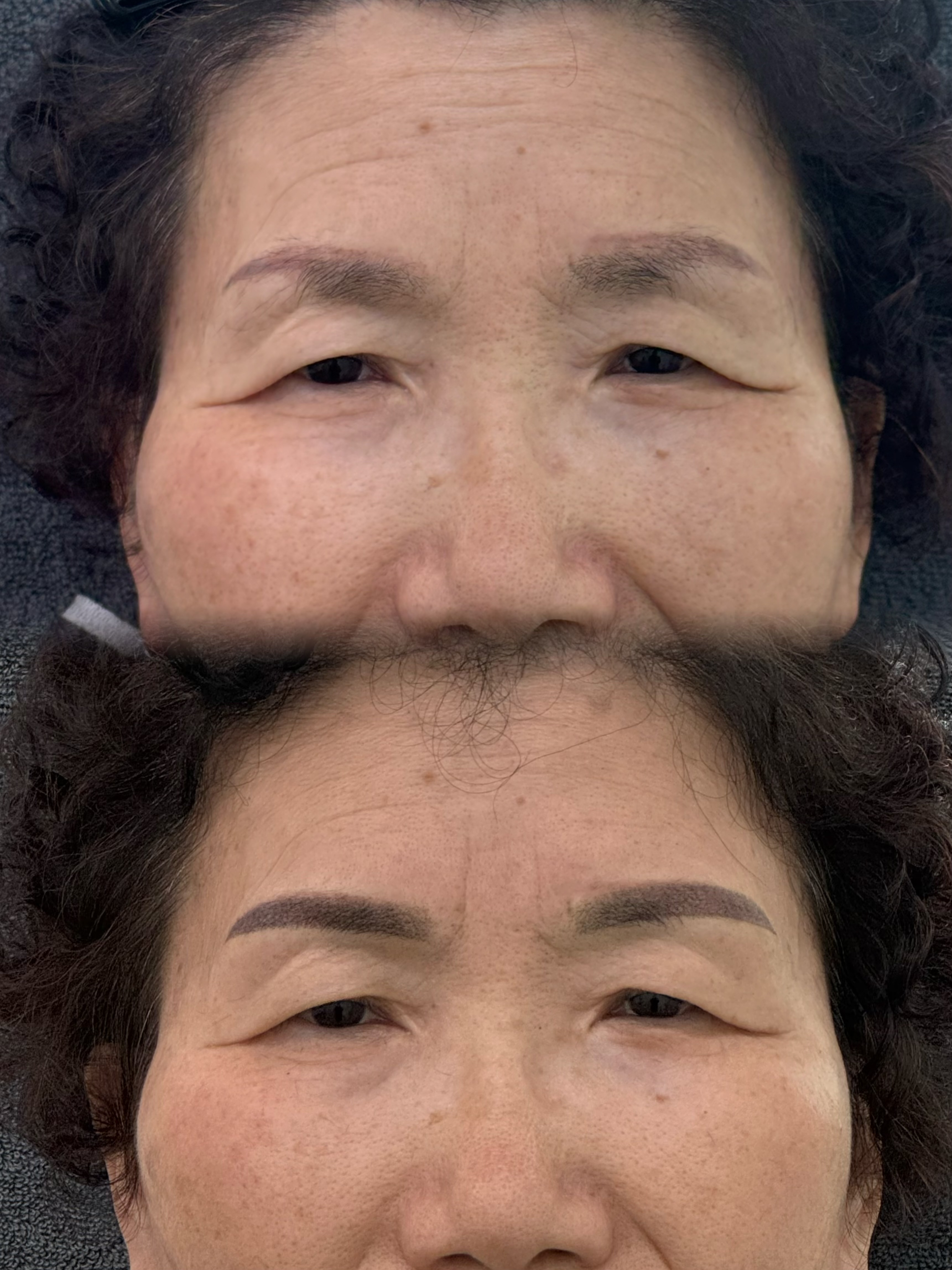 시술 사례 8