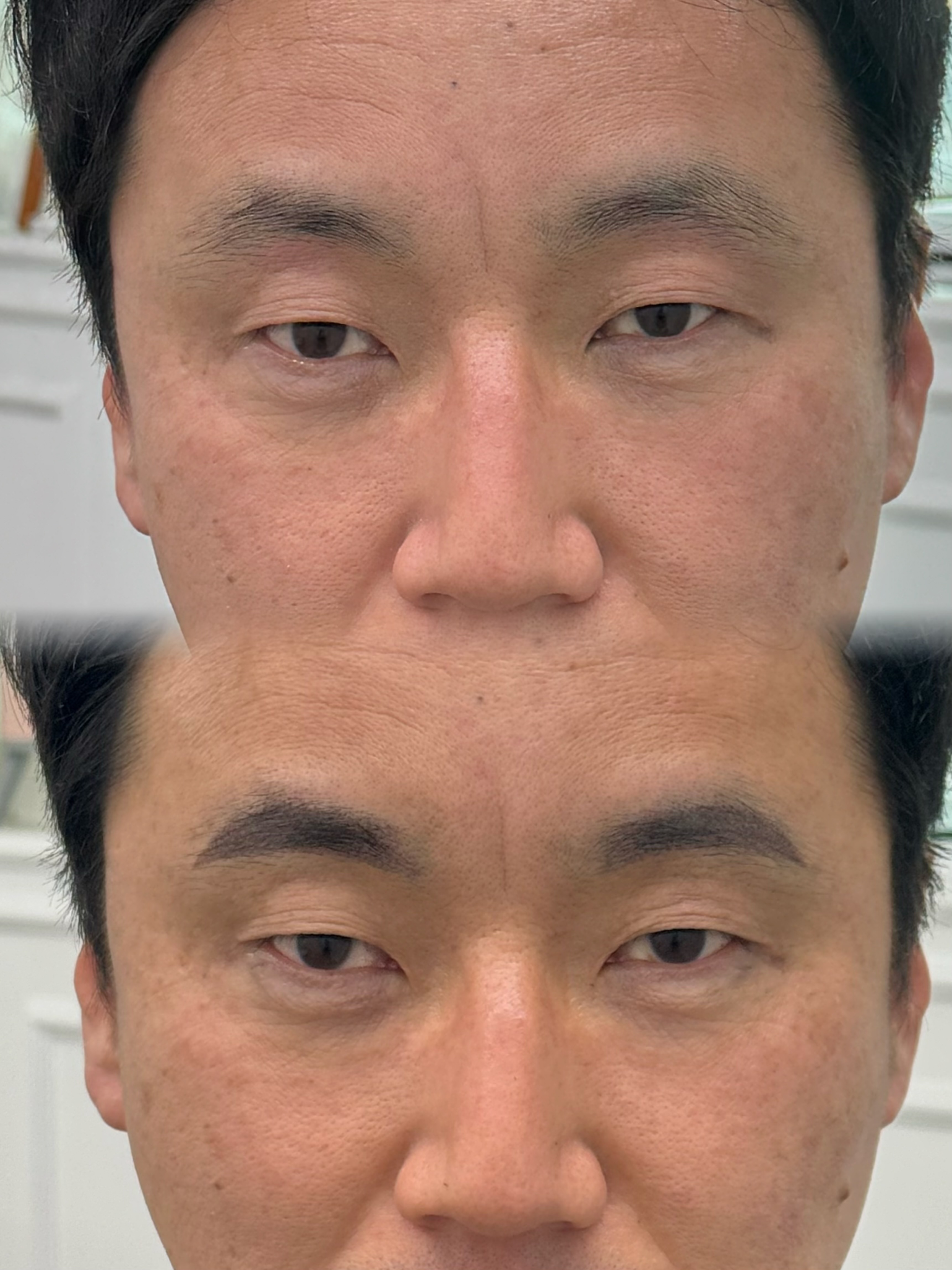 시술 사례 9