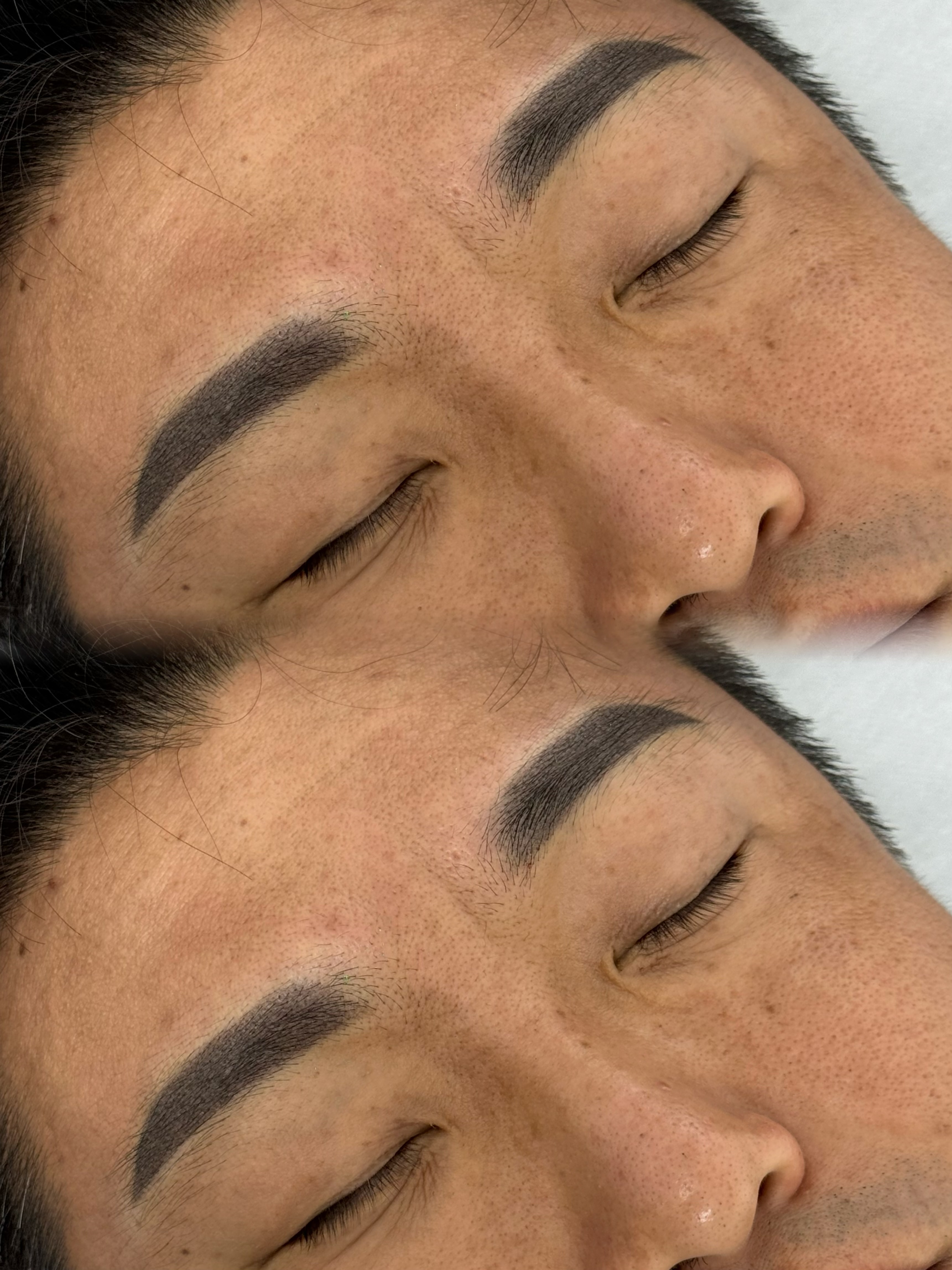 시술 사례 12